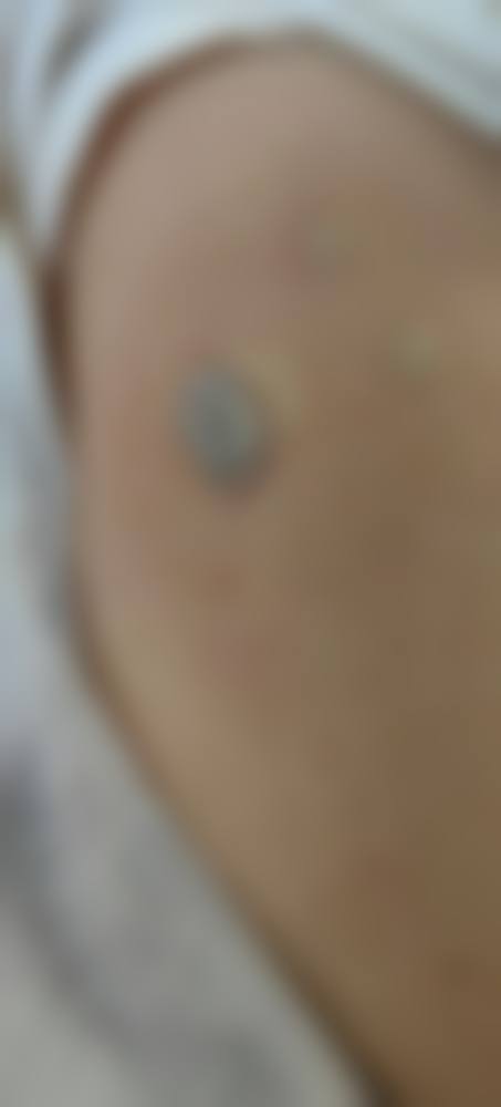 林伟华医生在哪家医院怎么预约?