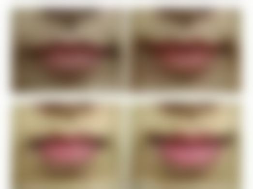 瘢痕疙瘩难以有效治疗？药物治疗显身手，改善症状有保护