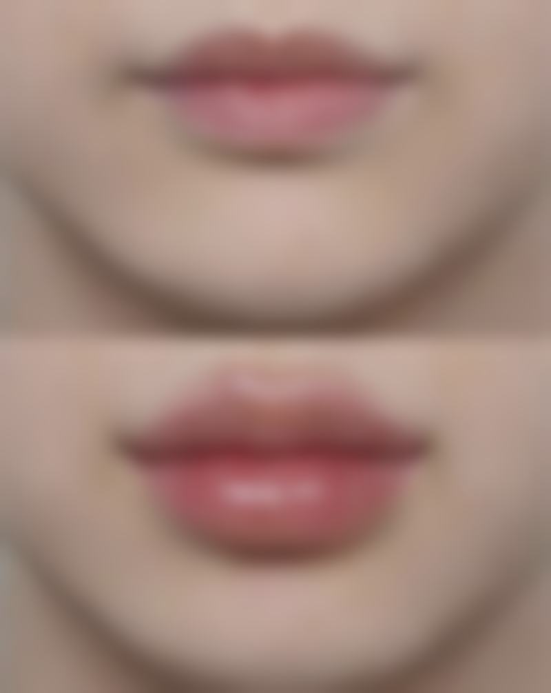 注射后注意事项，让成效更持久