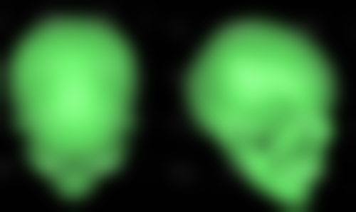 割双眼皮后吃草莓,温和无刺激