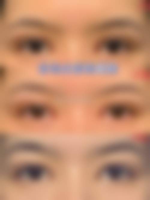 六、成都春天莱尔医疗美容诊所怎么预约：