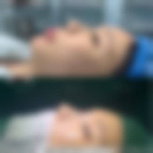 五、武汉江岸彼家美创整形医院实例