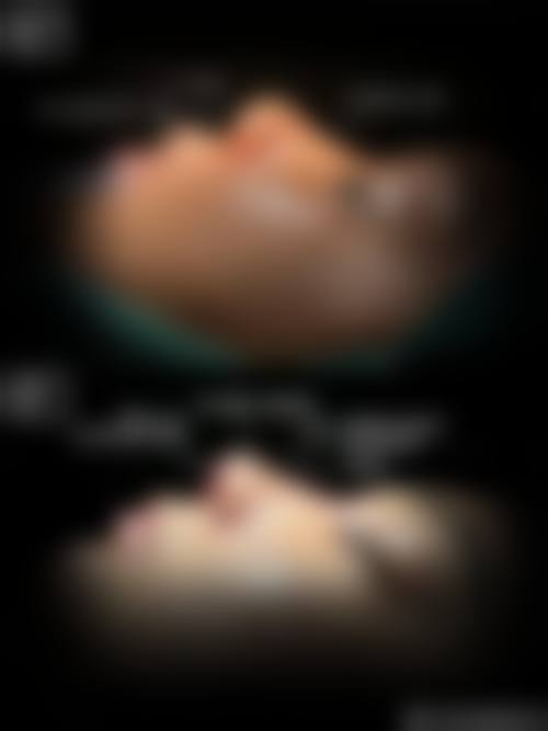 六、长沙雨花鳞颐整形医院怎么预约：