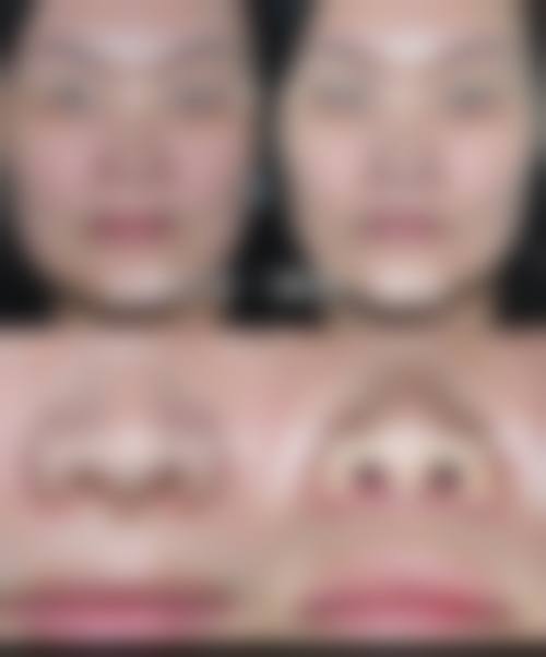 七、武汉江岸彼家美创整形医院价格表：（仅供参考）