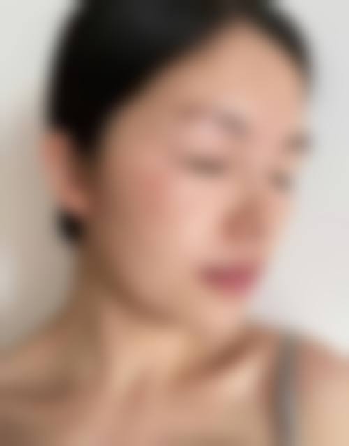 四、藤枝美容皮肤科实例