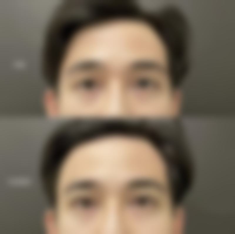 七、深圳康雪迩整形真实的顾客评价如下: