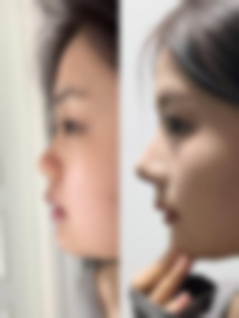 五、洛阳盛世美颜整形医院实例