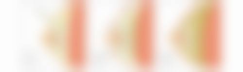 怎样去除中重度眼袋?手术治疗更完全