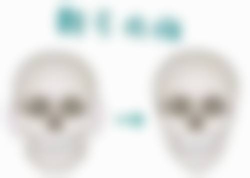 个体差异调整:因人而异的美丽方案