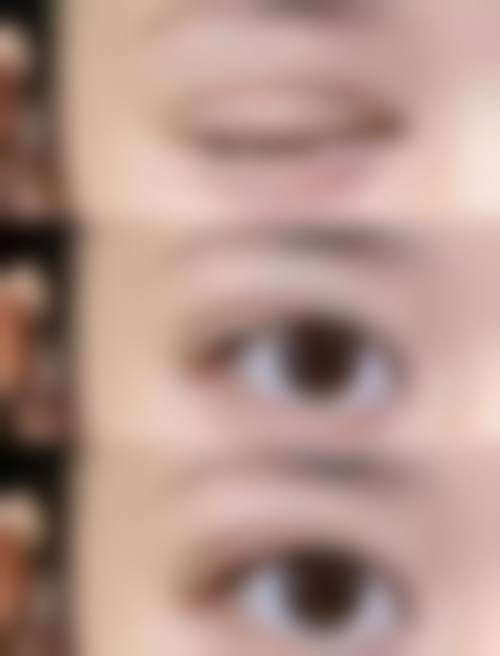 五、齐齐哈尔第一医院医疗美容科实例