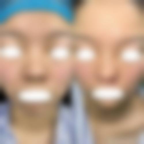 七、西安美丽宣言整形医院价格表：（仅供参考）