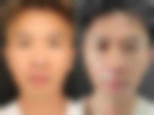 四、西安美丽宣言整形医院开展的主要项目和特色项目