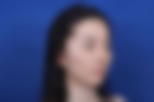 五、西安美丽宣言整形医院实例