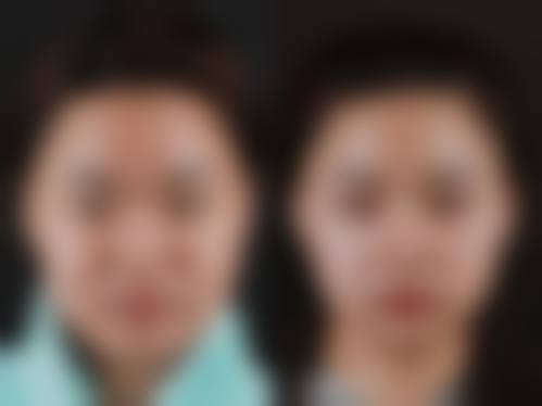 八、齐齐哈尔第一医院医疗美容科真实的顾客评价如下：