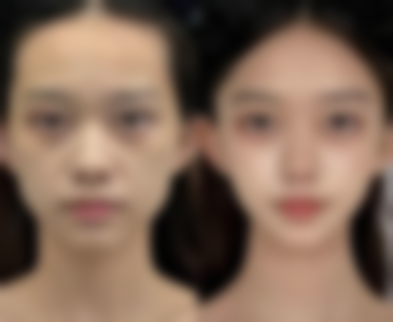 七、齐齐哈尔第一医院医疗美容科价格表：（仅供参考）