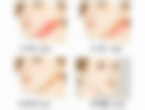 术后护理，决定成效的关键