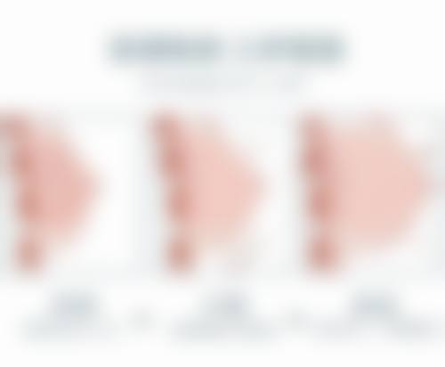 打瘦脸针成效百分百？其实存在不确定性