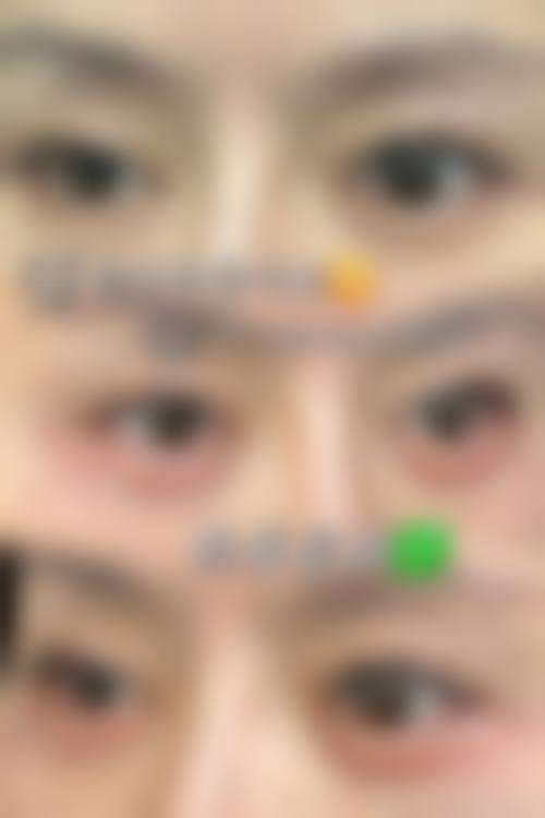 七、杭州港丽医疗美容诊所价格表：（仅供参考）