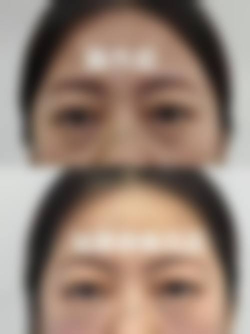 五、鸡西梁术仙整形医院怎么预约：