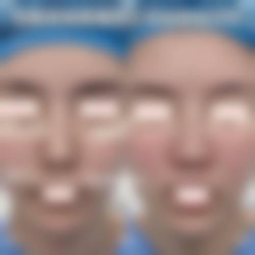 六、深圳美臣医疗美容医院怎么预约：