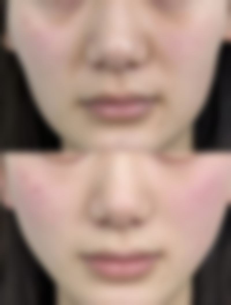 六、天津静海雅韵医疗美容门诊部价格表：（仅供参考）