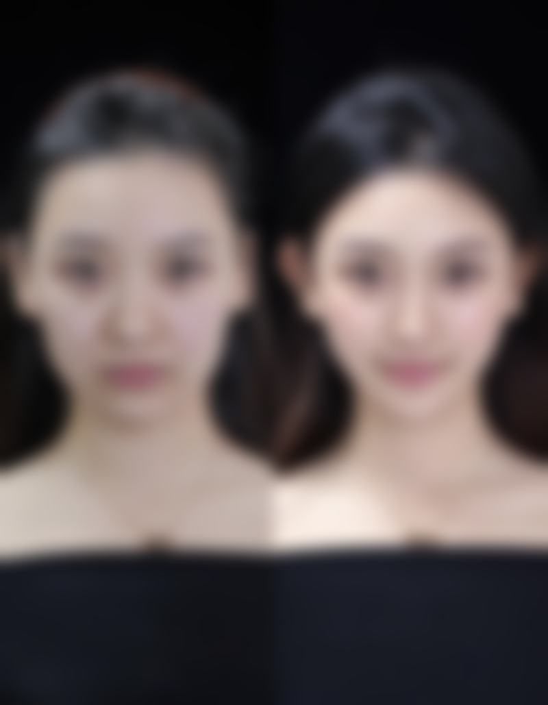 五、天津静海雅韵医疗美容门诊部怎么预约：