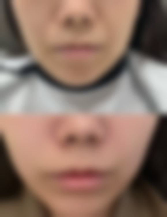 七、鸡西梁术仙整形医院真实的顾客评价如下：