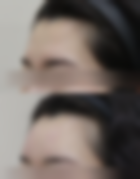 五、杭州港丽医疗美容诊所实例