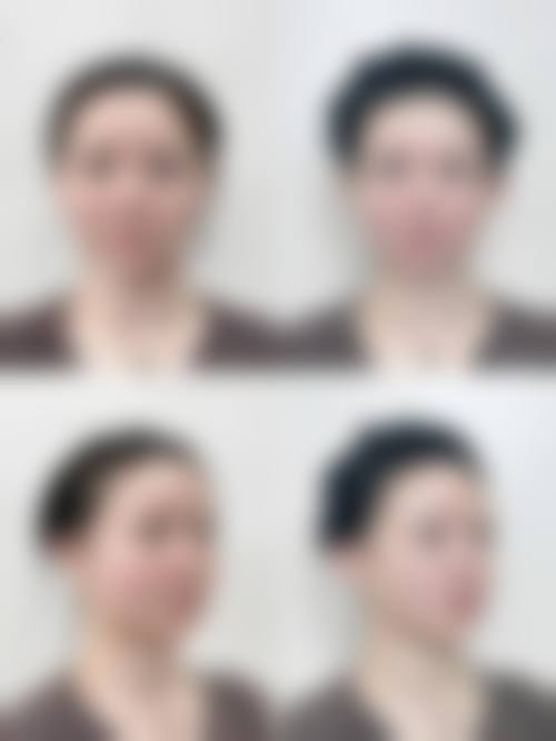 六、北京优樘医疗美容门诊部怎么预约：