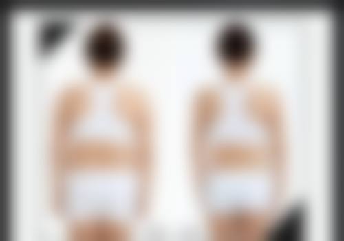 七、石家庄俏之翼医疗美容门诊部价格表：（仅供参考）