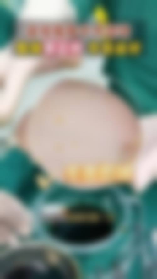 五、鞍山市中 心医院整形外科实例