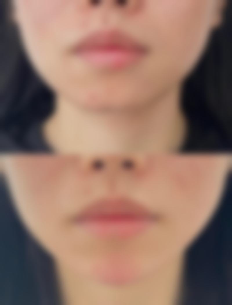 六、爱宝牙科医院价格表：（仅供参考）