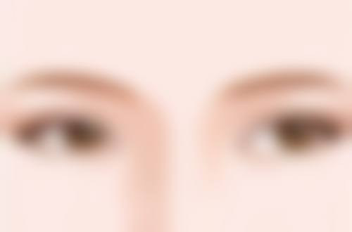 眼袋术后留疤别慌，物理治疗显神通