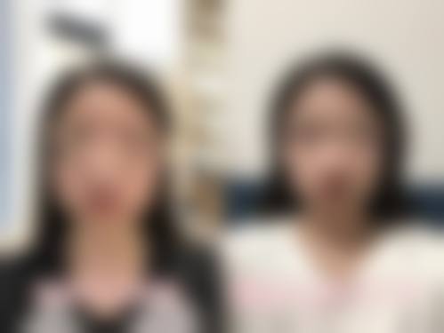 五、朝阳京城皮肤医院整形科实例