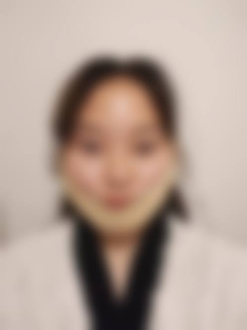 五、庆阳医师乔红英整形医院实例