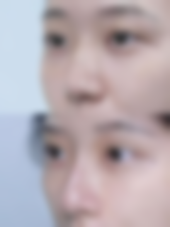 五、韩国TIARA整形医院实例