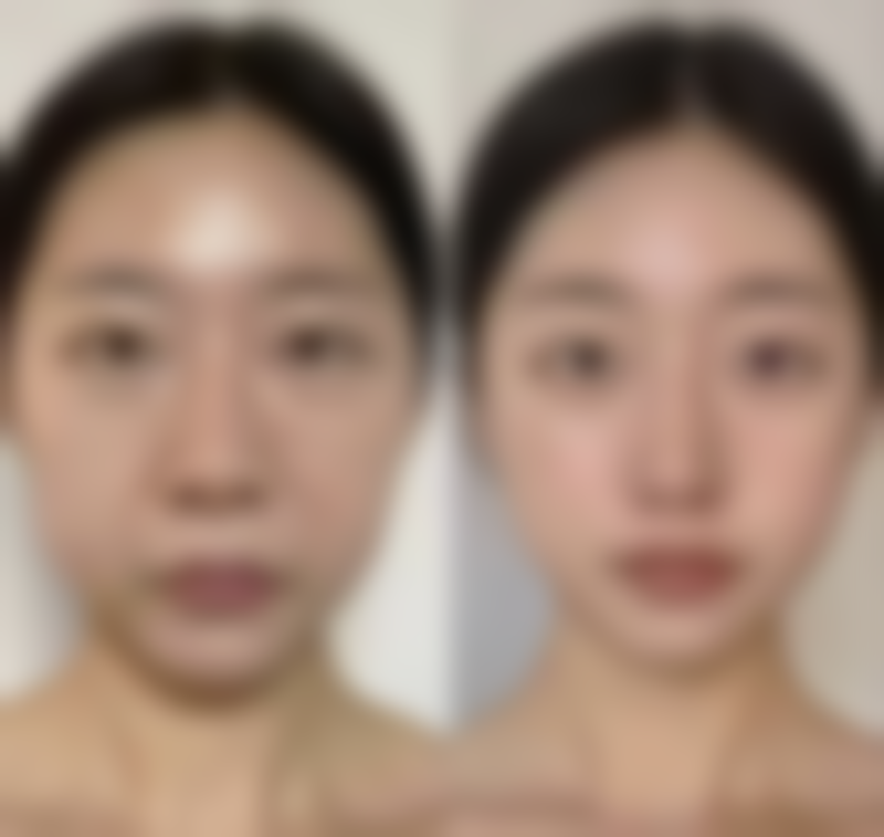 有眼袋黑眼圈困扰？试试睡眠改善，有效淡化焕新彩