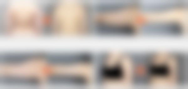 赵敏英(千户兰斯院长)医生项目价格表参考