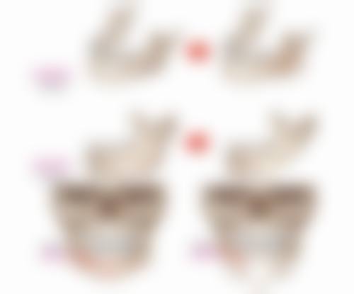 长期被黑眼袋困扰是咋回事？用眼过度有原因