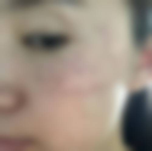 六、筑后SkinCare诊所价格表：（仅供参考）