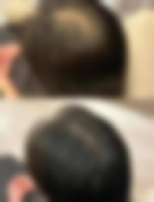 六、上海徐汇科发源植发整形（旗舰店）价格表：（仅供参考）