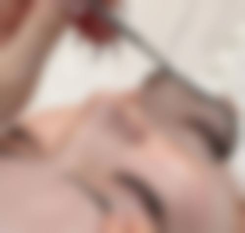 四、上海徐汇科发源植发整形（旗舰店）实例