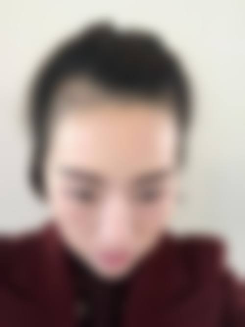 五、上海徐汇科发源植发整形（旗舰店）怎么预约：