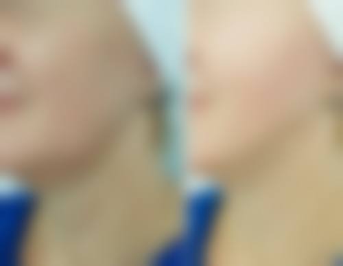 六、杭州耀然整形医疗美容医院价格表：（仅供参考）