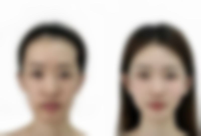 小孩积食眼袋深，药物治疗和其他中医疗法有哪些？