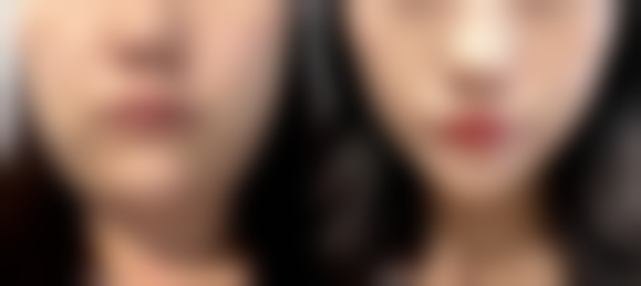 李在河医生实例