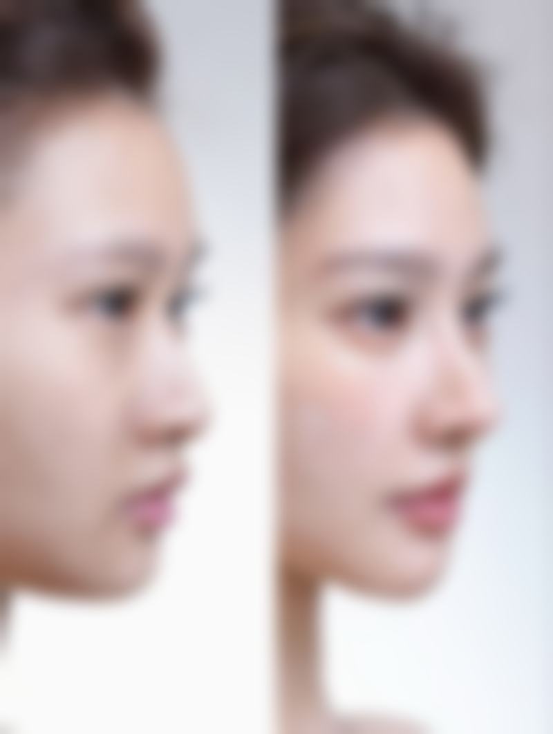 四、杭州耀然整形医疗美容医院实例