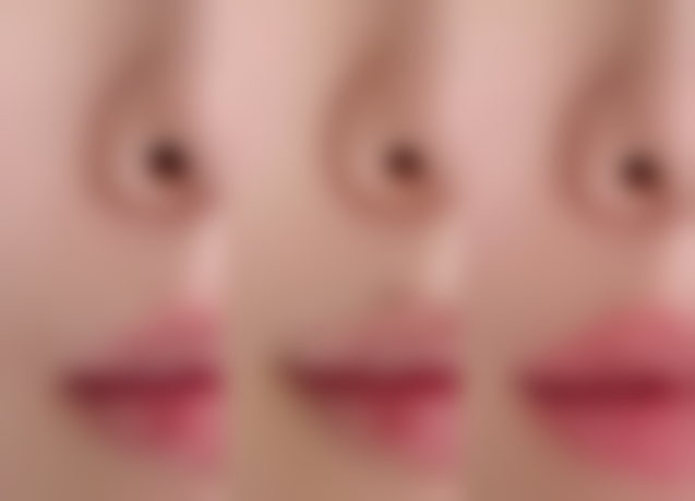 光电治疗疤痕修复效果究竟怎样？深入剖析其淡化痕迹、促进肌肤再生的显著优势 