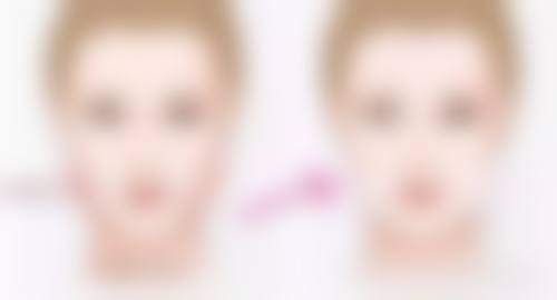 硅胶隆胸能否喂奶？手术操作减少组织损伤