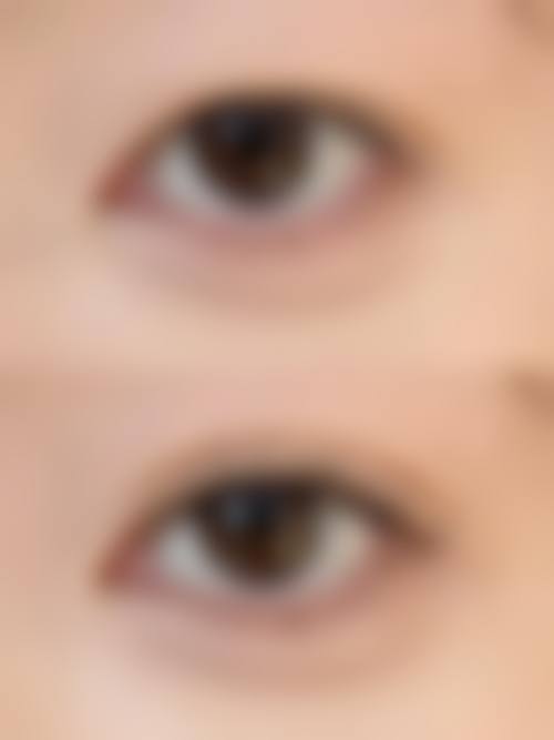 崔培培医生在哪家医院怎么预约？